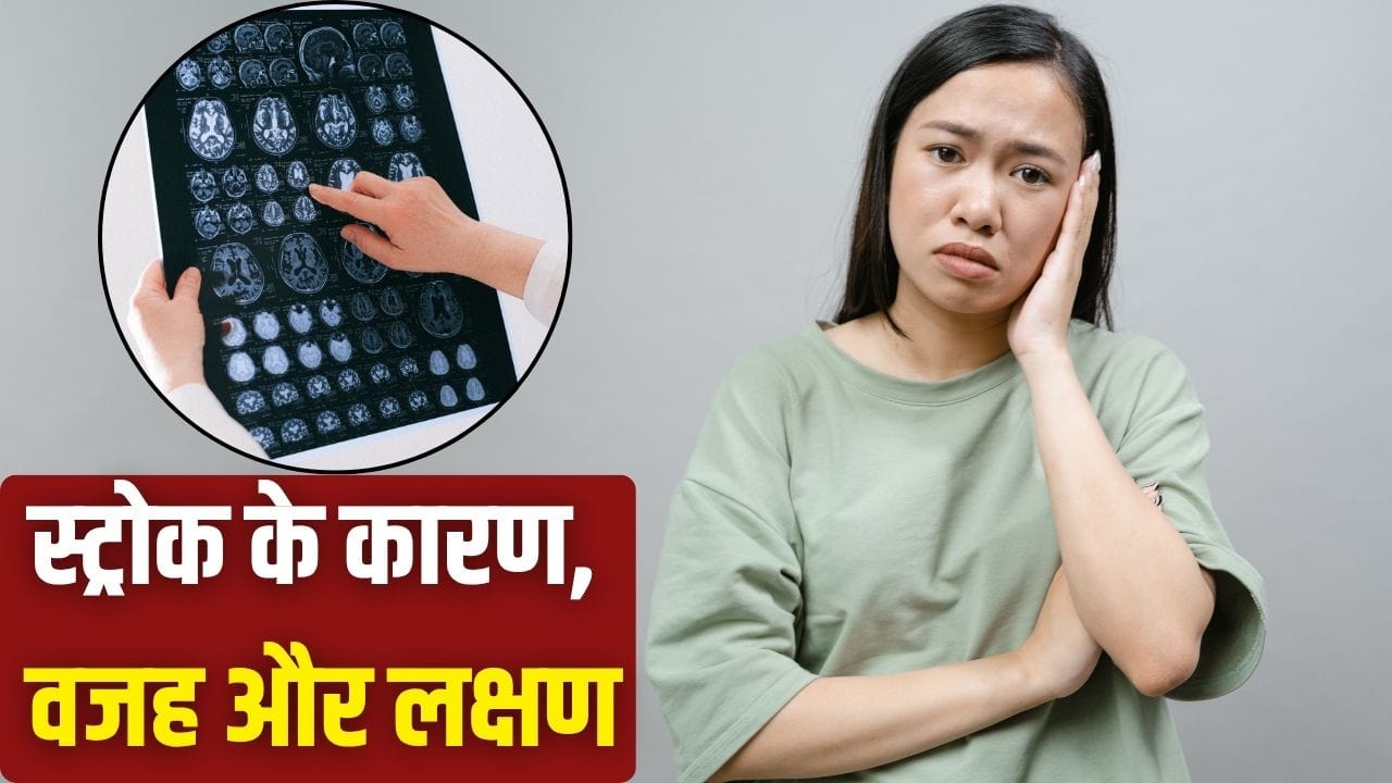 डॉक्टरों ने बताया: स्ट्रोक के शुरुआती लक्षण और बचाव के उपाय